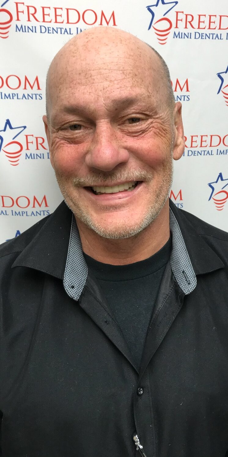 Home Dr. Regan Ackerman. Freedom Mini Dental Implants. Mini Dental Implants in Louisville Kentucky 40291