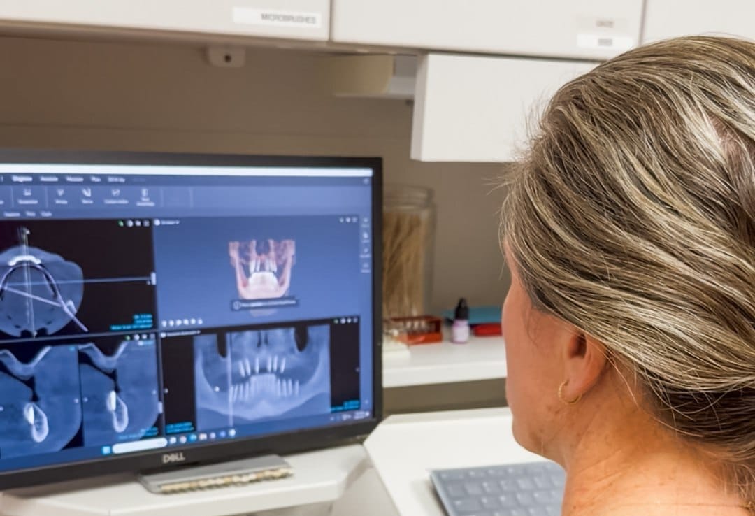 Dentist explaining a dental model to an older patient
