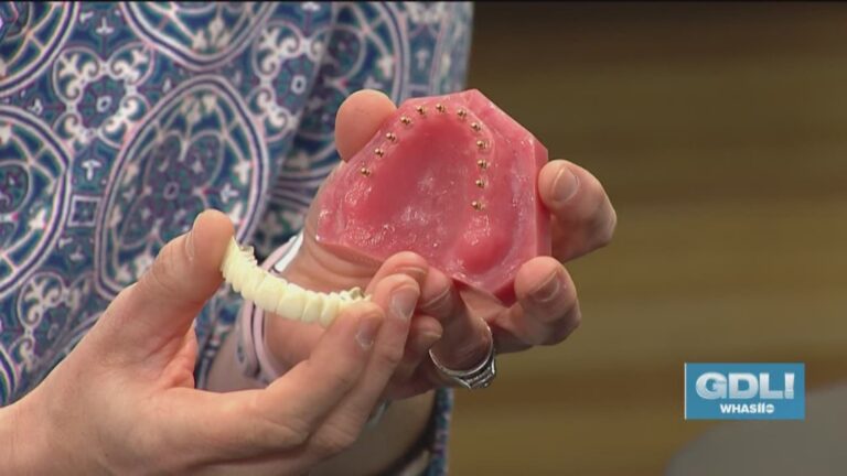 Implants, dentures, and bridges: how the options differ