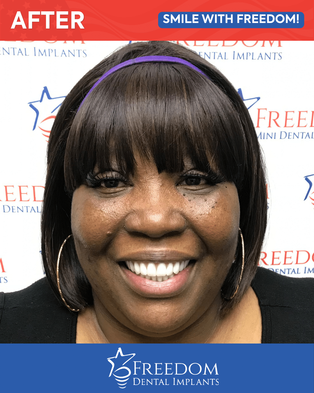 After-treatment smile photo from Freedom Dental Implants in Louisville