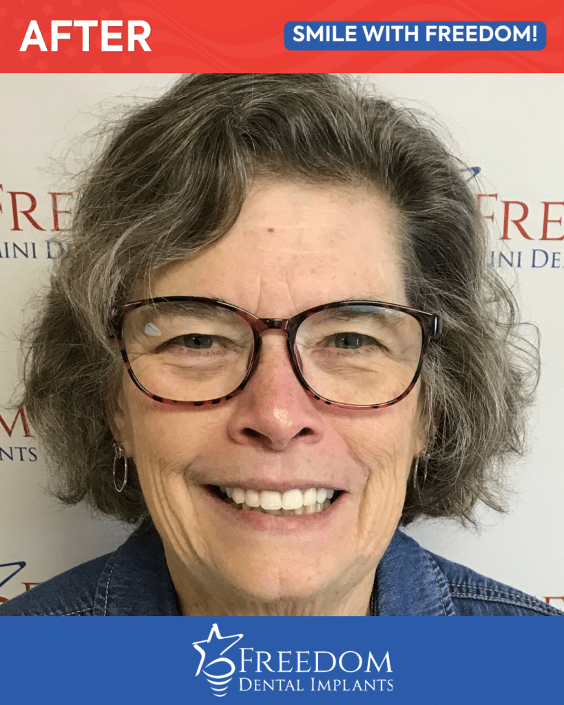 After-treatment smile photo from Freedom Dental Implants in Louisville