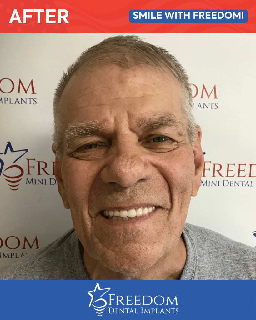 After-treatment smile photo from Freedom Dental Implants in Louisville