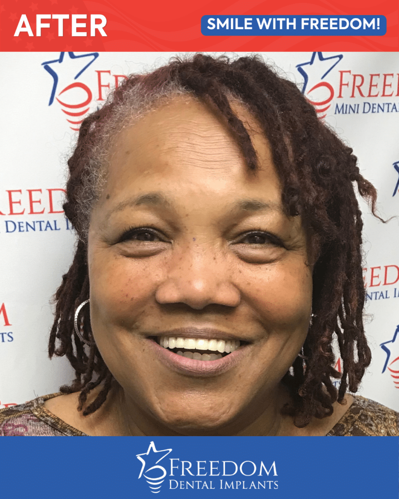 After-treatment smile photo from Freedom Dental Implants in Louisville