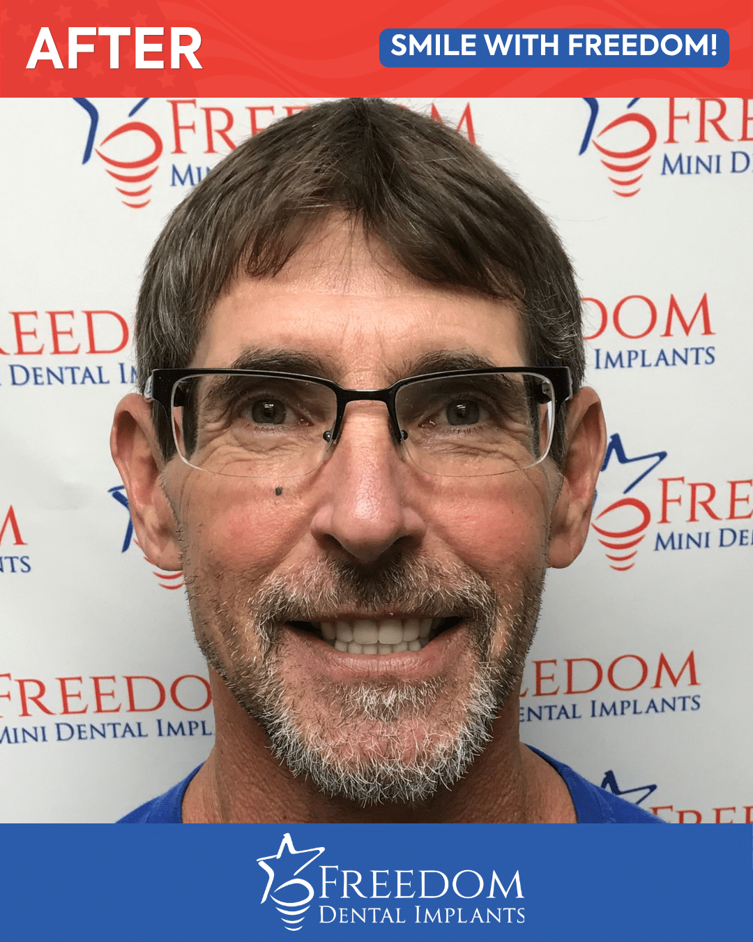 After-treatment smile photo from Freedom Dental Implants in Louisville