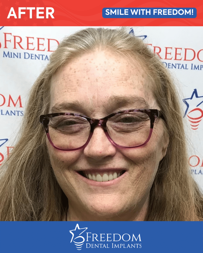 After-treatment smile photo from Freedom Dental Implants in Louisville