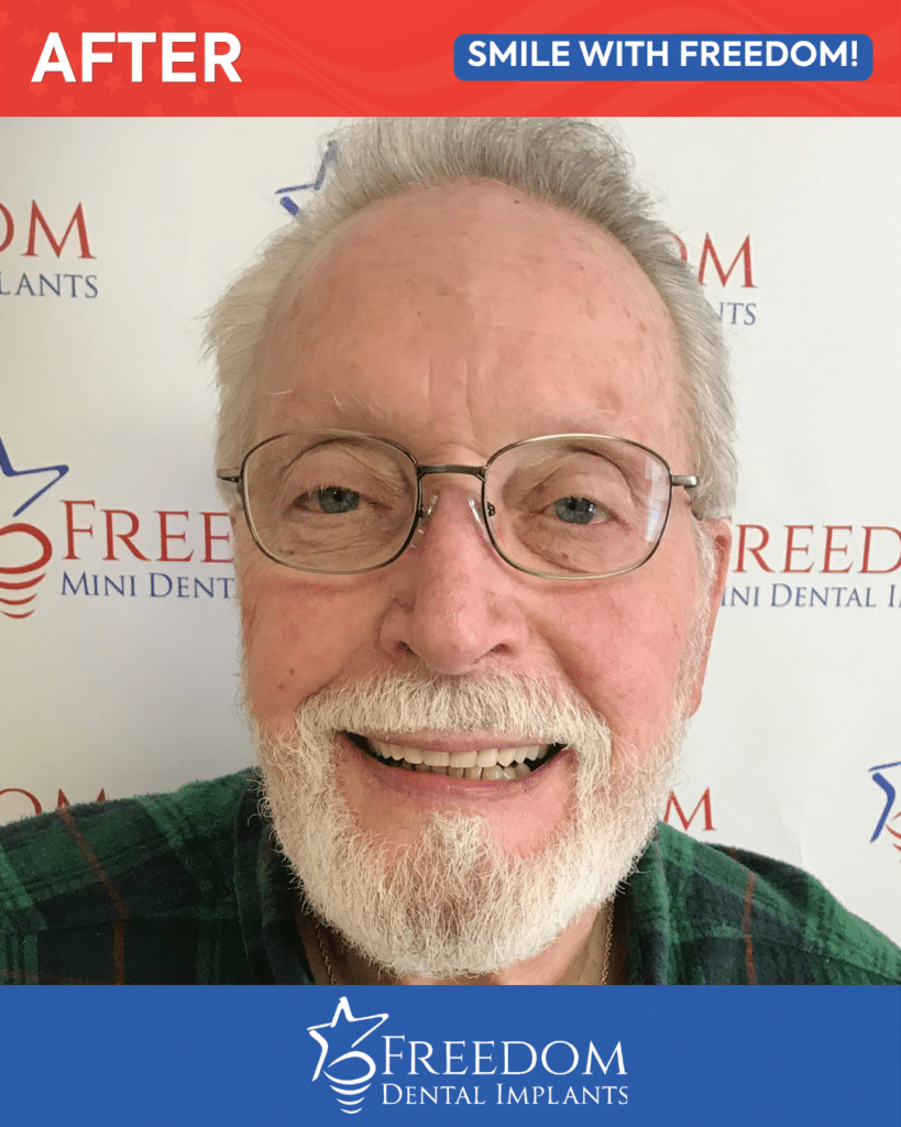 After-treatment smile photo from Freedom Dental Implants in Louisville
