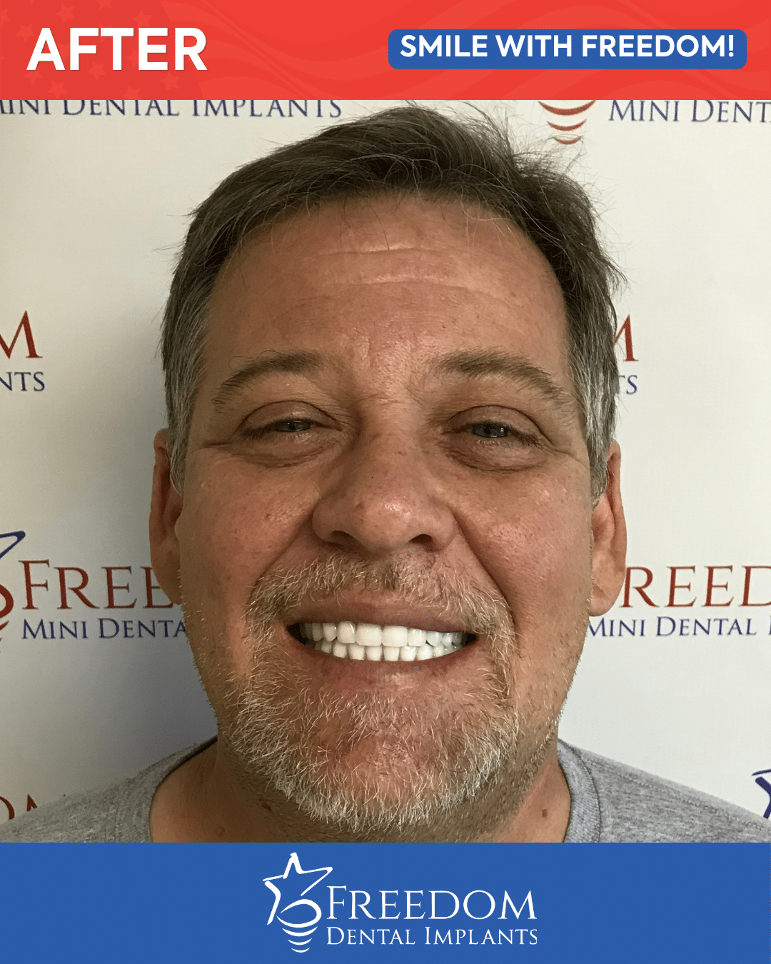 After-treatment smile photo from Freedom Dental Implants in Louisville