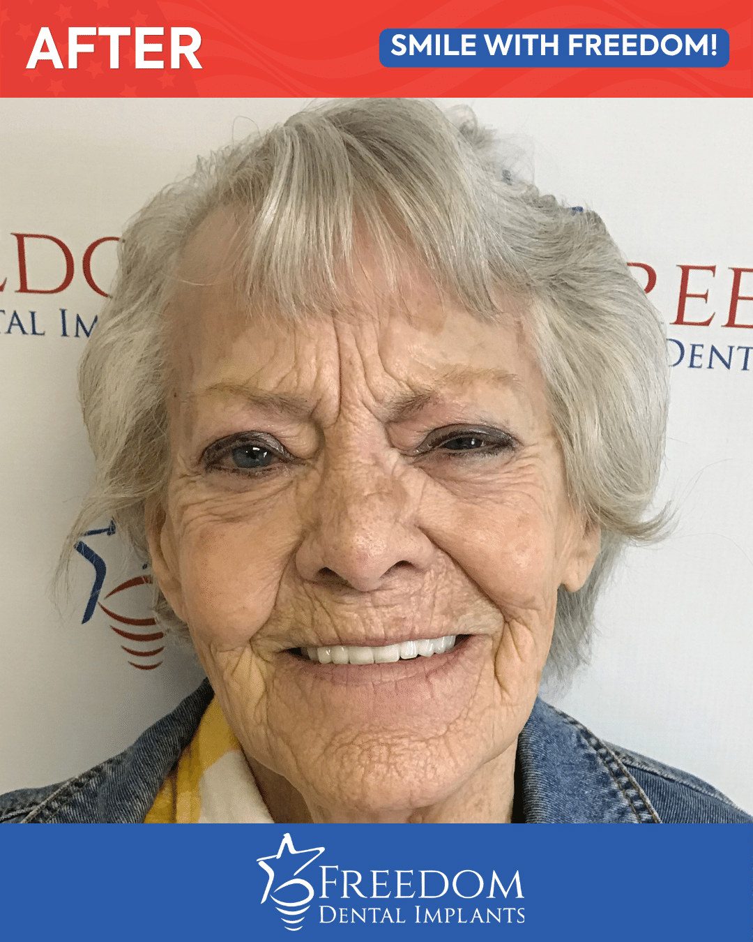 After-treatment smile photo from Freedom Dental Implants in Louisville