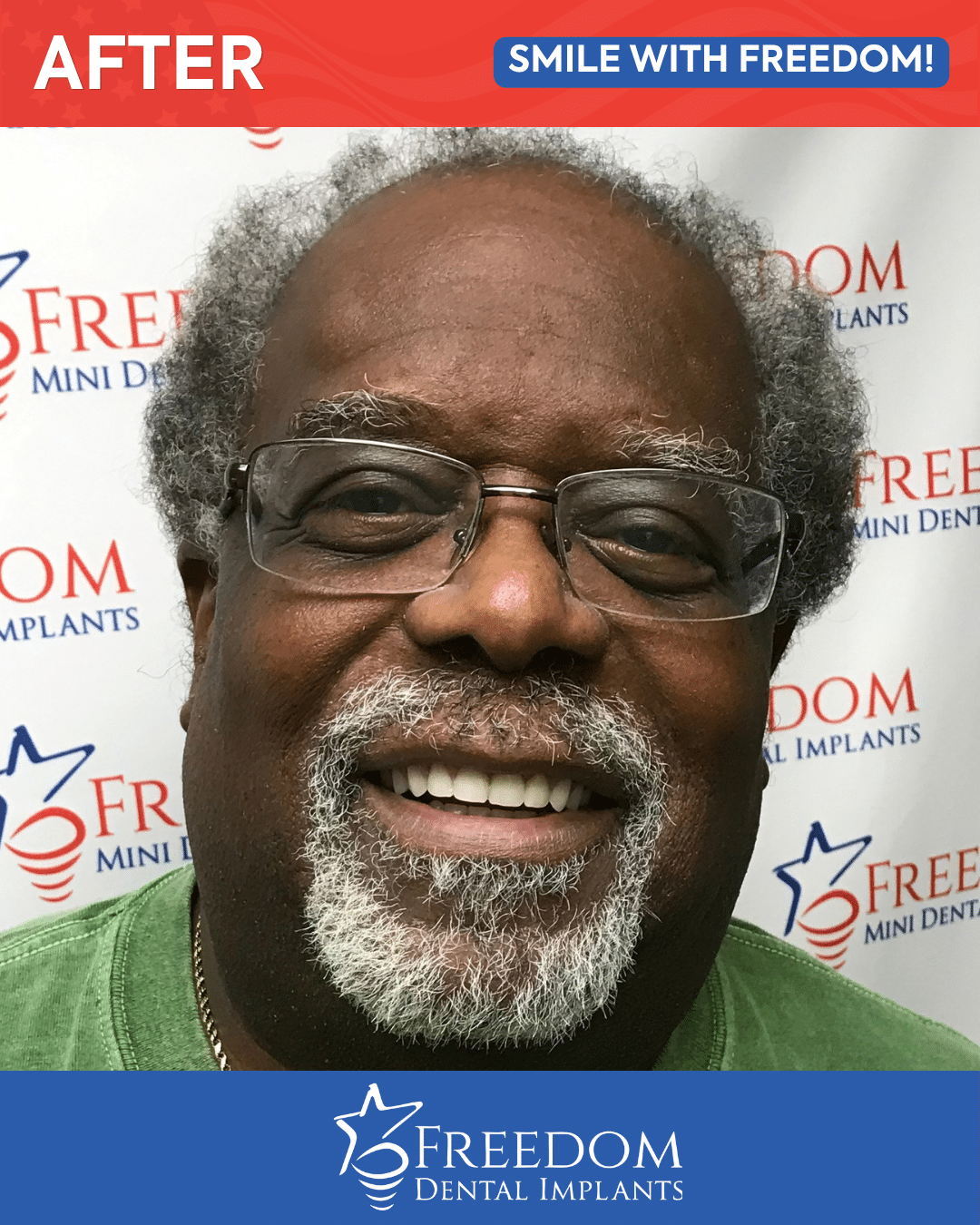After-treatment smile photo from Freedom Dental Implants in Louisville