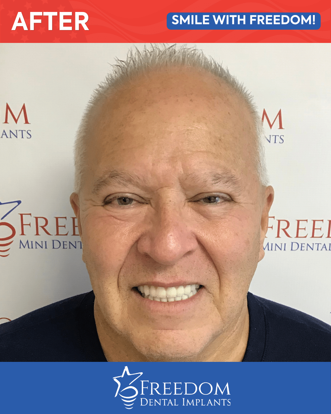 After-treatment smile photo from Freedom Dental Implants in Louisville