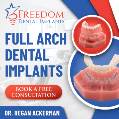 Full Arch Dental Implants in Louisville, KY | Book a Free Consultations