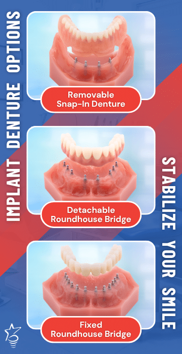 Implant Denture Options in Louisville, KY | Book a Free Consultation