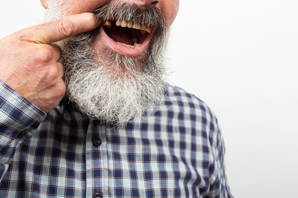 Single Tooth Implant