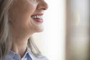 Patient smile after mini dental implant placement in Louisville